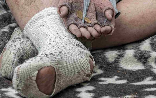 E' costretto a chiedere l'elemosina
